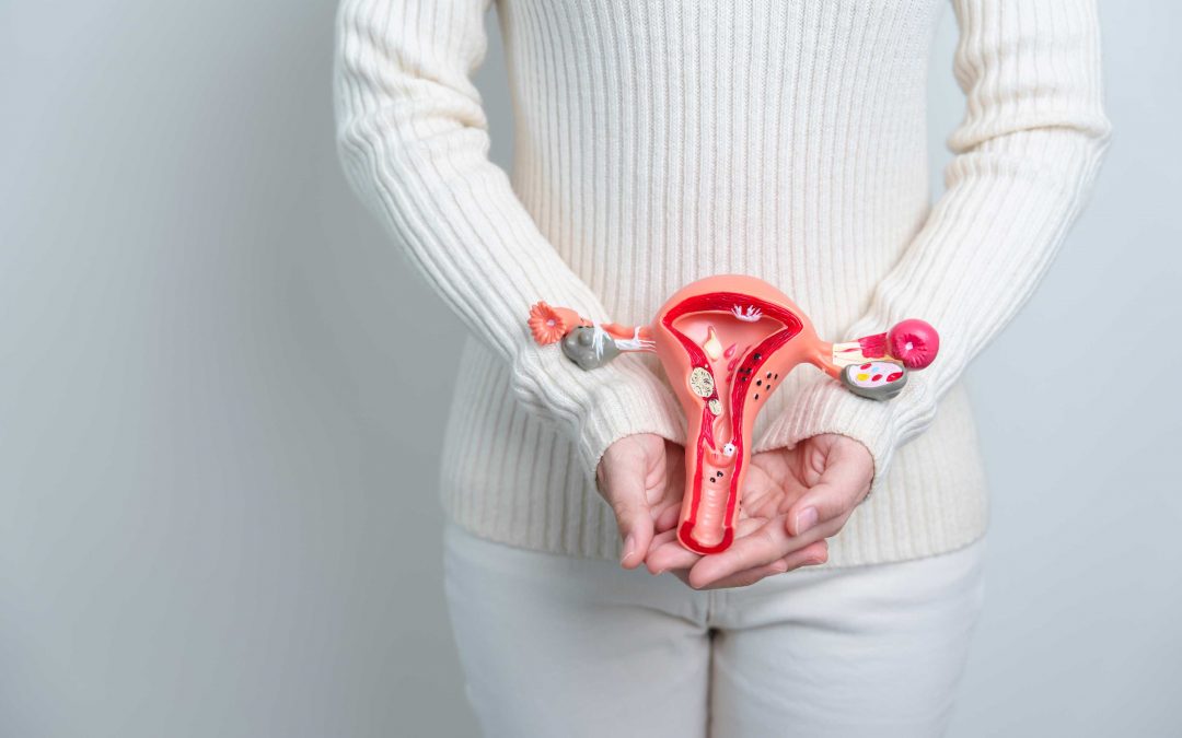 Endometriose und Adenomyose